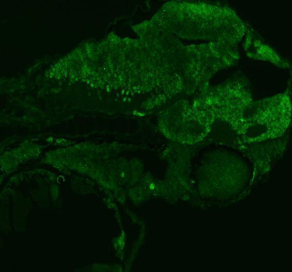 azq6azb7 fhl2a b primary antibodies if testing 5