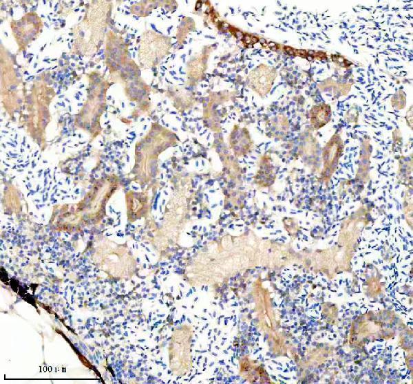 azq6azb7 fhl2a b primary antibodies ihc testing 1