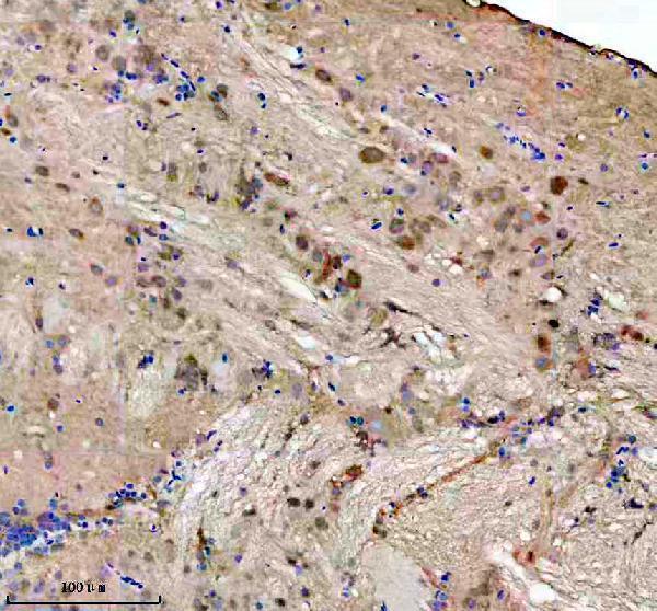 azq6azb7 fhl2a b primary antibodies ihc testing 2