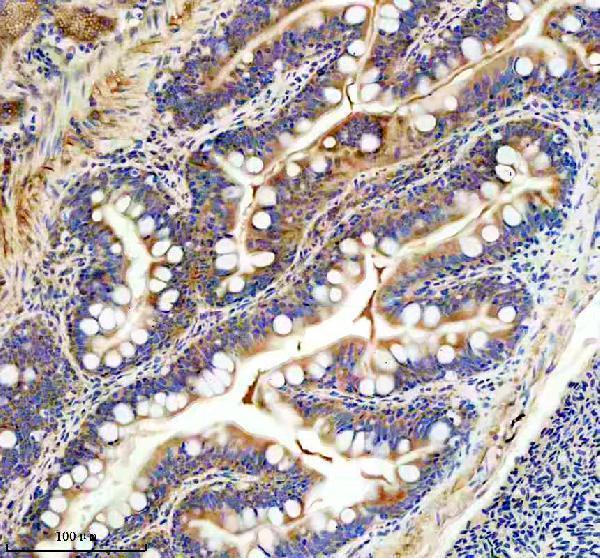 azq6azb7 fhl2a b primary antibodies ihc testing 3