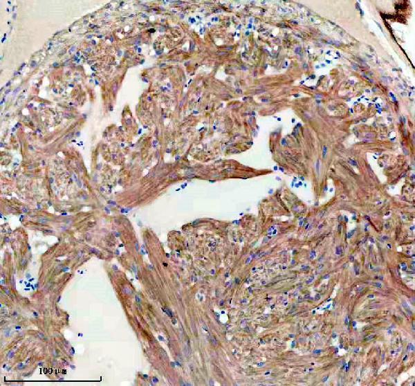 azq6azb7 fhl2a b primary antibodies ihc testing 4