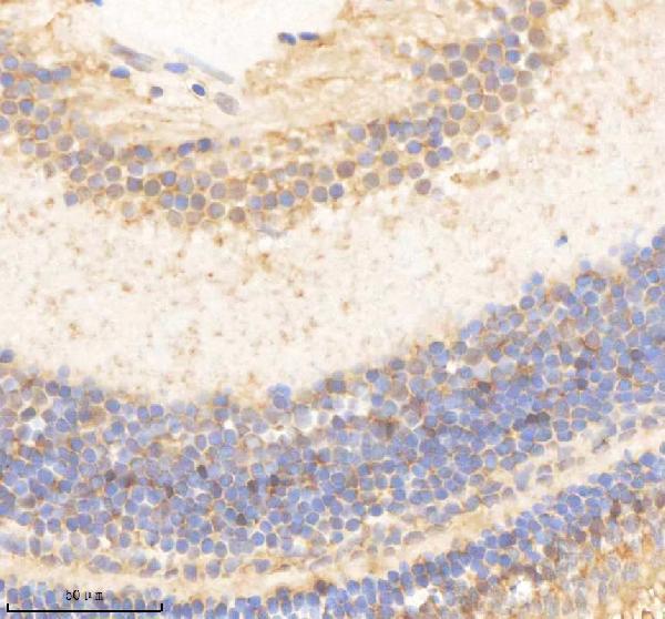 IHC analysis of PSMC5 using anti-PSMC5 antibody (AZQ6AZC1)