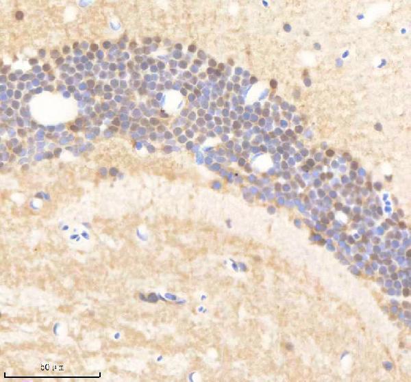 IHC analysis of PSMC5 using anti-PSMC5 antibody (AZQ6AZC1)