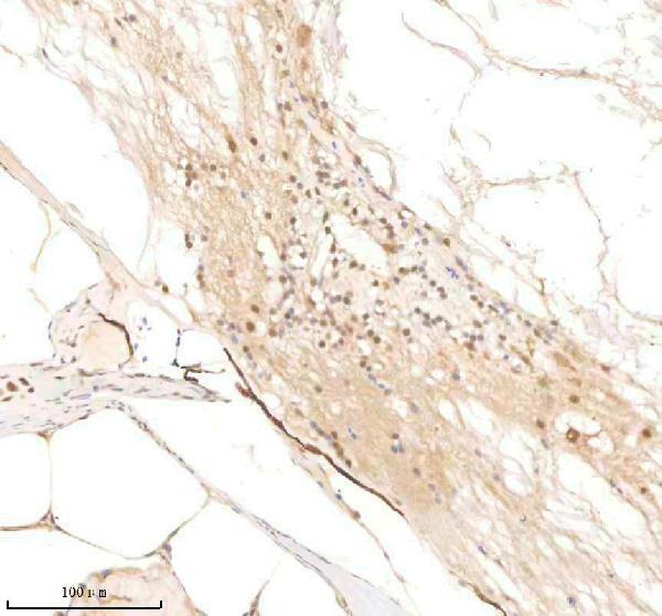 IHC analysis of PSMC5 using anti-PSMC5 antibody (AZQ6AZC1)