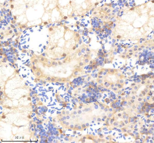 azq6azc1 psmc5 primary antibodies ihc testing 4