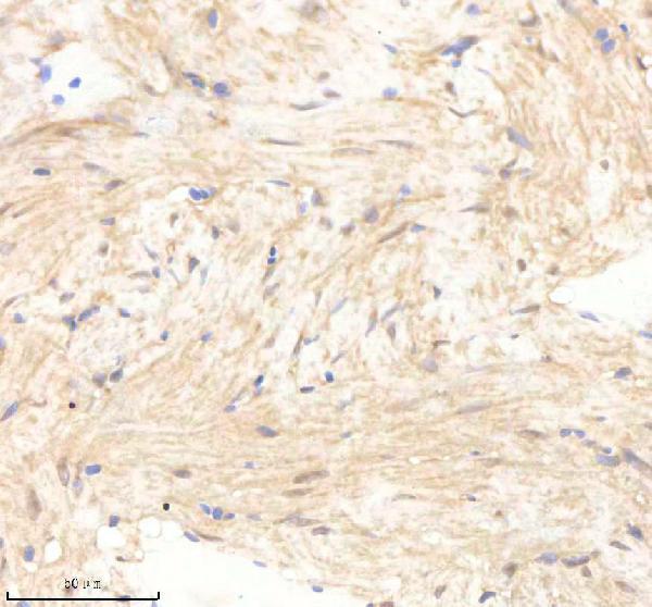 azq6azc1 psmc5 primary antibodies ihc testing 5
