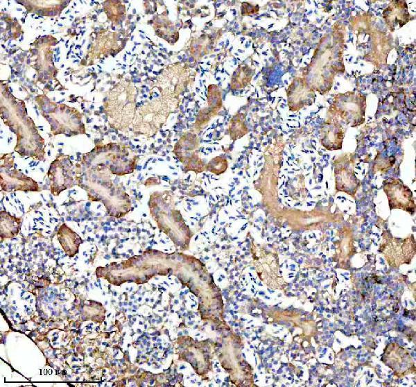  IHC analysis of GIPC1 using anti-GIPC1 antibody (AZQ6B337)