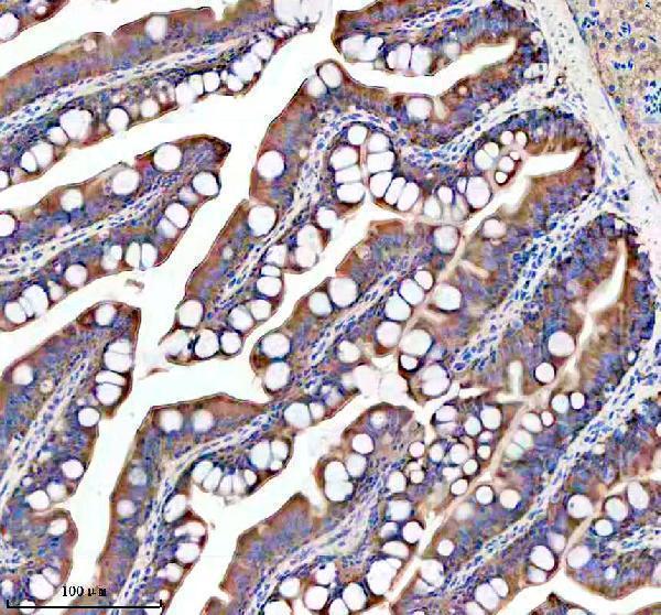  IHC analysis of GIPC1 using anti-GIPC1 antibody (AZQ6B337)