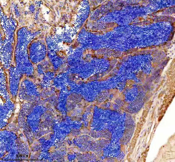 azq6b337 gipc1 primary antibodies ihc testing 4