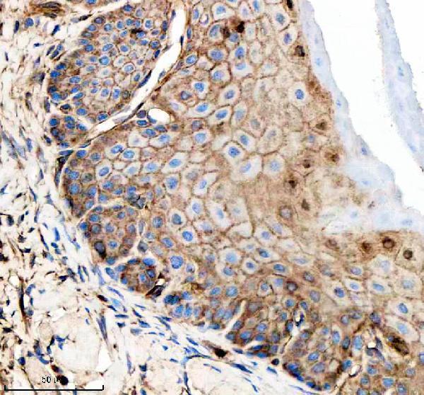 azq6b337 gipc1 primary antibodies ihc testing 5