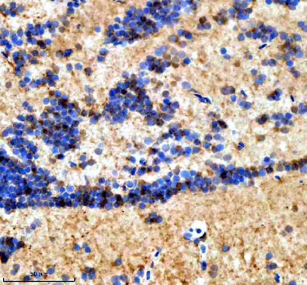 azq6dc03 suz12a b primary antibodies ihc testing 1