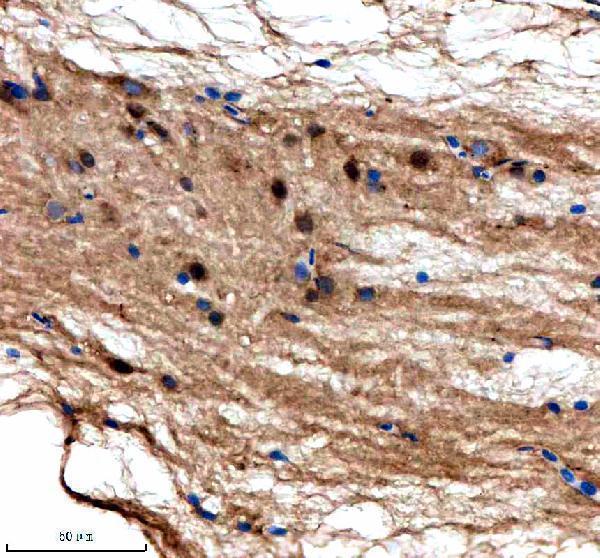azq6dc03 suz12a b primary antibodies ihc testing 2