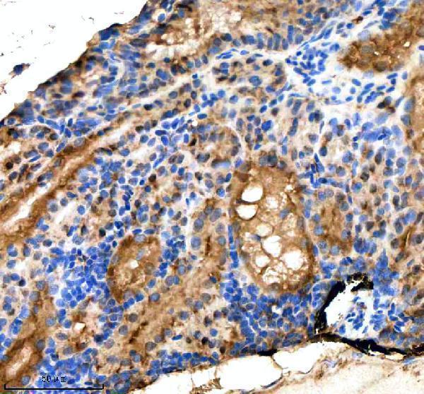 azq6dc03 suz12a b primary antibodies ihc testing 3