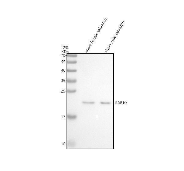  Western blot analysis of RAB10 using anti-RAB10 antibody (AZQ6DGV5)