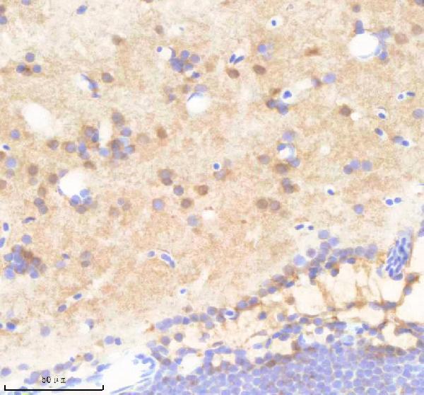 IHC analysis of PSMA1 using anti-PSMA1 antibody (AZQ6DGX8)