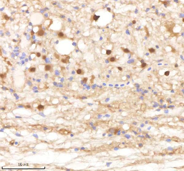 IHC analysis of PSMA1 using anti-PSMA1 antibody (AZQ6DGX8)