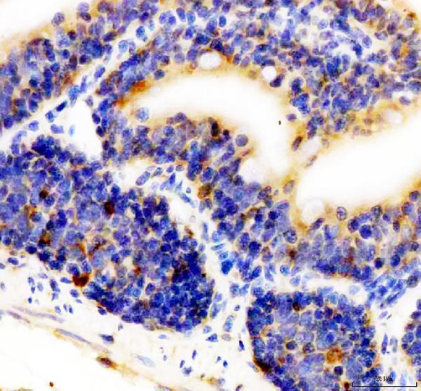 IHC analysis of CD36 using anti-CD36 antibody (AZQ6DHC7)