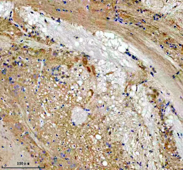 azq6dhh7 lzic primary antibodies ihc testing 1