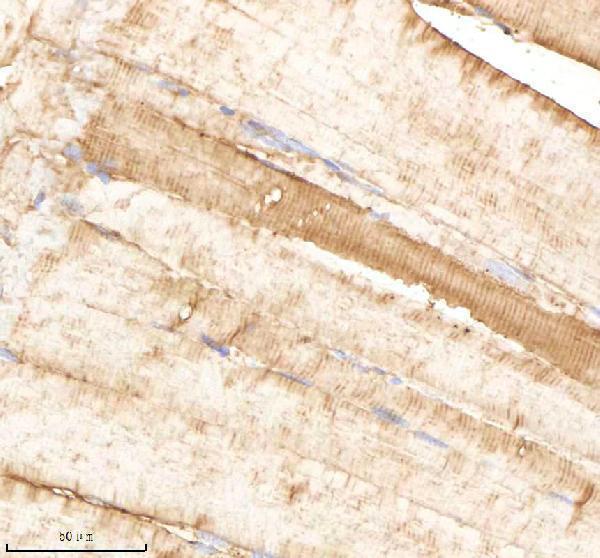IHC analysis of PSMB1 using anti-PSMB1 antibody (AZQ6DRF3)