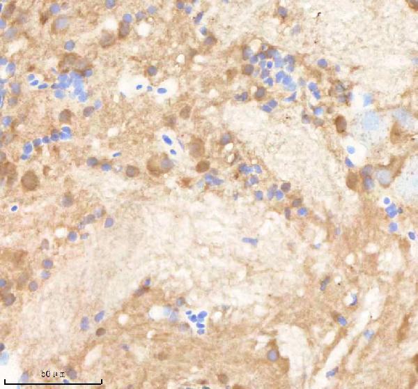 IHC analysis of PPP1R12A using anti-PPP1R12A antibody (AZQ6DRG7)