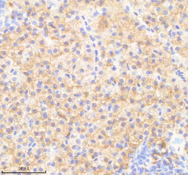 IHC analysis of PPP1R12A using anti-PPP1R12A antibody (AZQ6DRG7)