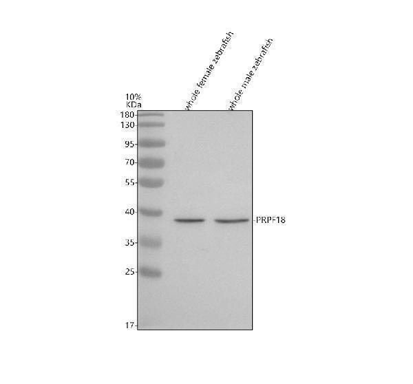 Western blot analysis of PRPF18 using anti-PRPF18 antibody (AZQ6GMH0)
