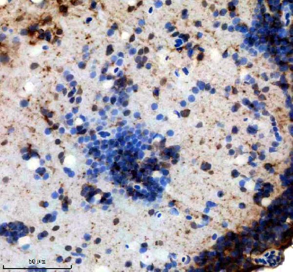 IHC analysis of FABP6 using anti-FABP6 antibody (AZQ6IMW5)