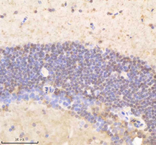 IHC analysis of PSMD8 using anti-PSMD8 antibody (AZQ6IQH4)