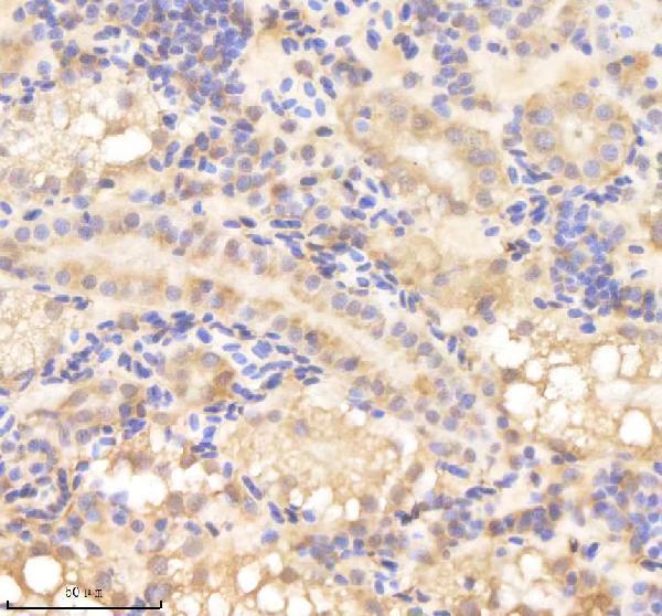 IHC analysis of PSMD8 using anti-PSMD8 antibody (AZQ6IQH4)