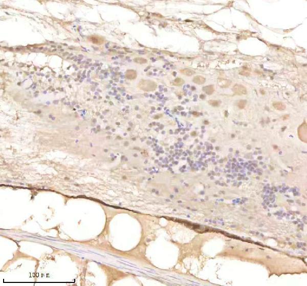 IHC analysis of PSMD8 using anti-PSMD8 antibody (AZQ6IQH4)