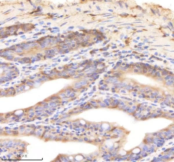 azq6iqh4 psmd8 primary antibodies ihc testing 4