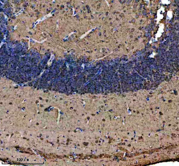 azq6iqn6 atp5mc1 2 3 primary antibodies ihc testing 2