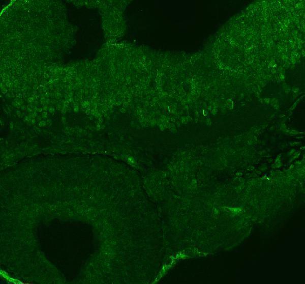 azq6iqu7 ints12 primary antibodies if testing 1