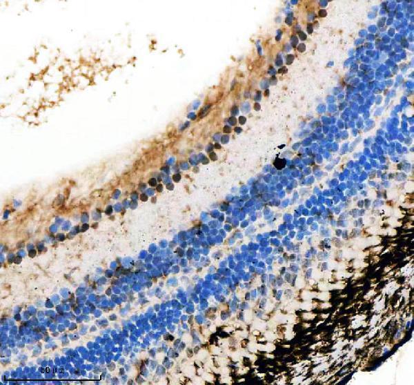  IHC analysis of INTS12 using anti-INTS12 antibody (AZQ6IQU7)