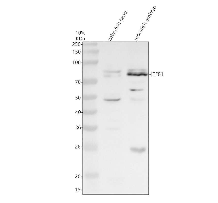 Western blot analysis of IFT81 using anti-IFT81 antibody (AZQ6IVW2)