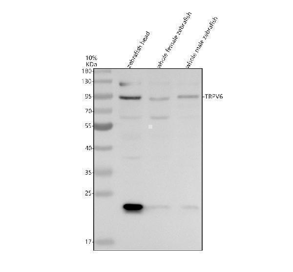Western blot analysis of TRPV6 using anti-TRPV6 antibody (AZQ6JQN0)