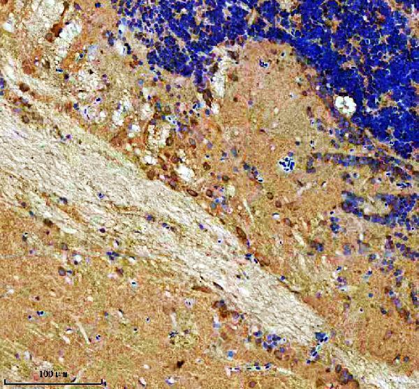 azq6nuv0 rab3gap1 primary antibodies ihc testing 2