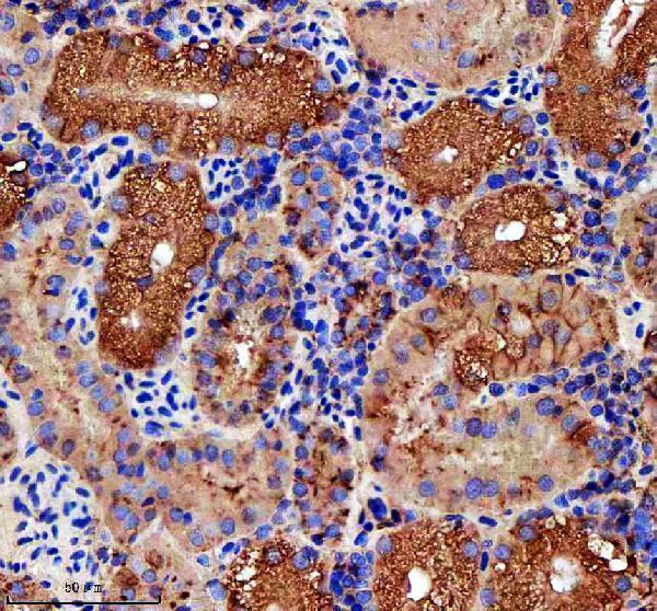 azq6nuv0 rab3gap1 primary antibodies ihc testing 3