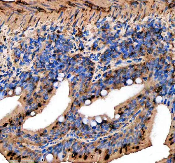 azq6nuv0 rab3gap1 primary antibodies ihc testing 4