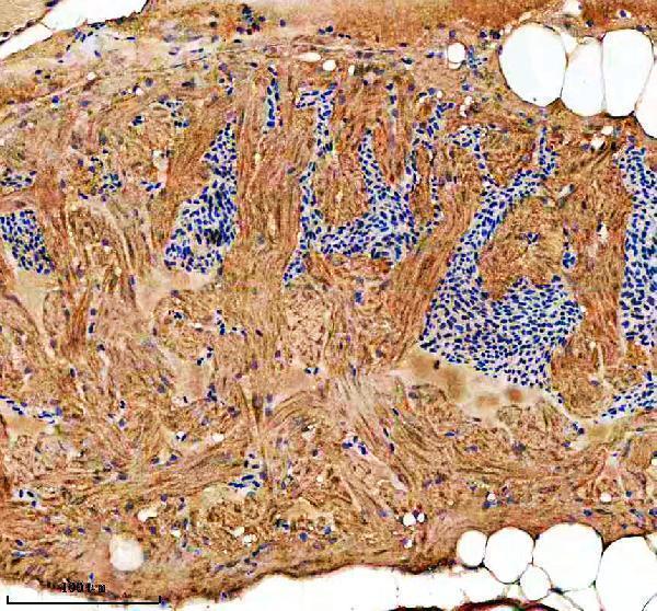 azq6nuv0 rab3gap1 primary antibodies ihc testing 5