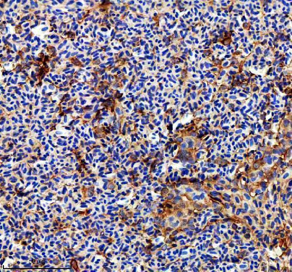 azq6nuv0 rab3gap1 primary antibodies ihc testing 7