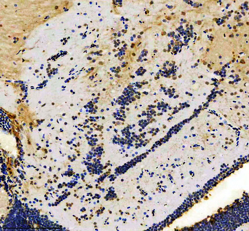 azq6nw59 atf4 primary antibodies ihc testing 1