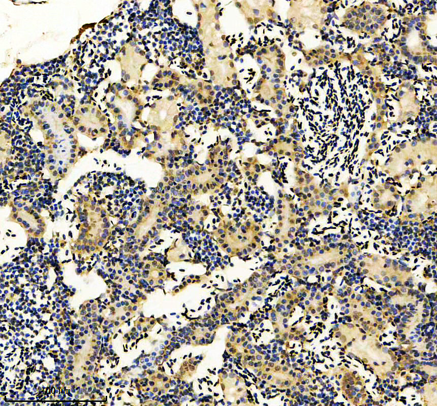 azq6nw59 atf4 primary antibodies ihc testing 2