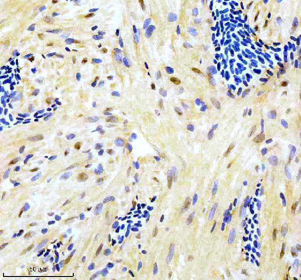 azq6nw63 gata6 primary antibodies ihc testing 1