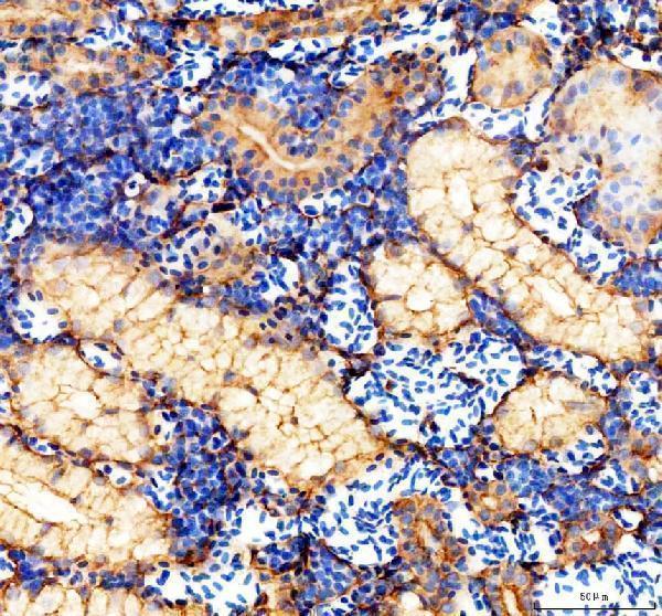 IHC analysis of KRT8 using anti-KRT8 antibody (AZQ6NWF6)