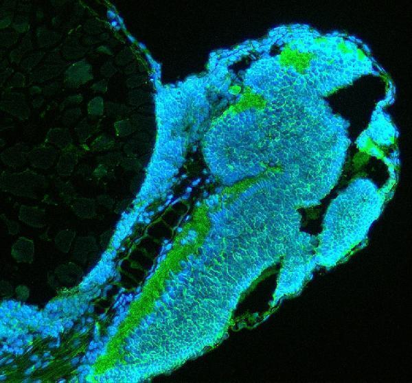 azq6nwk7 tuba1a primary antibodies if testing 1