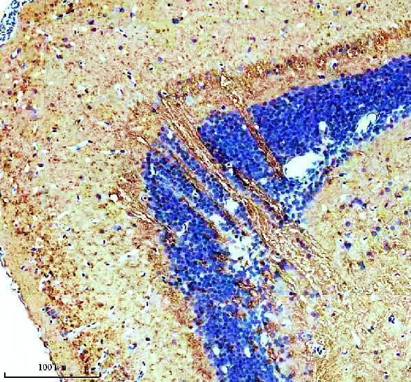 azq6nwk7 tuba1a primary antibodies ihc testing 1
