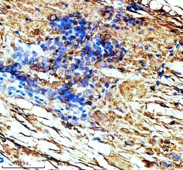 azq6nwk7 tuba1a primary antibodies ihc testing 2