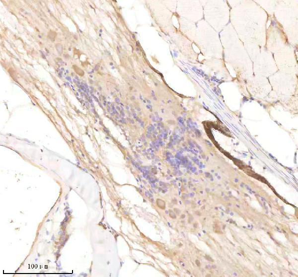 IHC analysis of RCC2 using anti-RCC2 antibody (AZQ6NYE2)