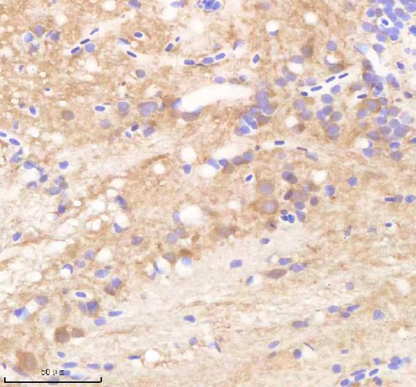 IHC analysis of RCC2 using anti-RCC2 antibody (AZQ6NYE2)